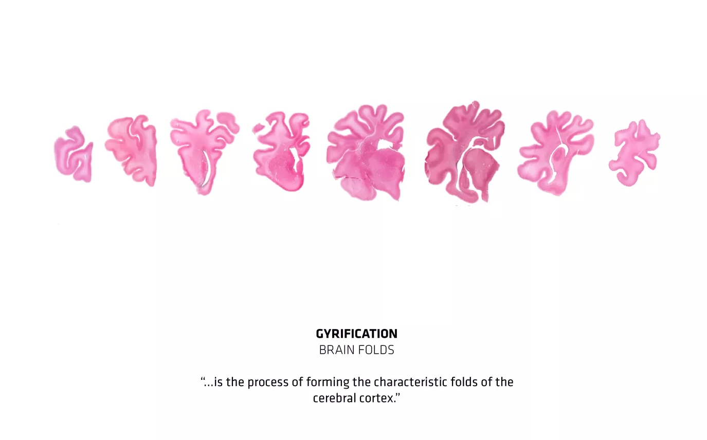 丹麦神经科学和精神病学中心丨丹麦奥胡斯丨BIG建筑事务所-10