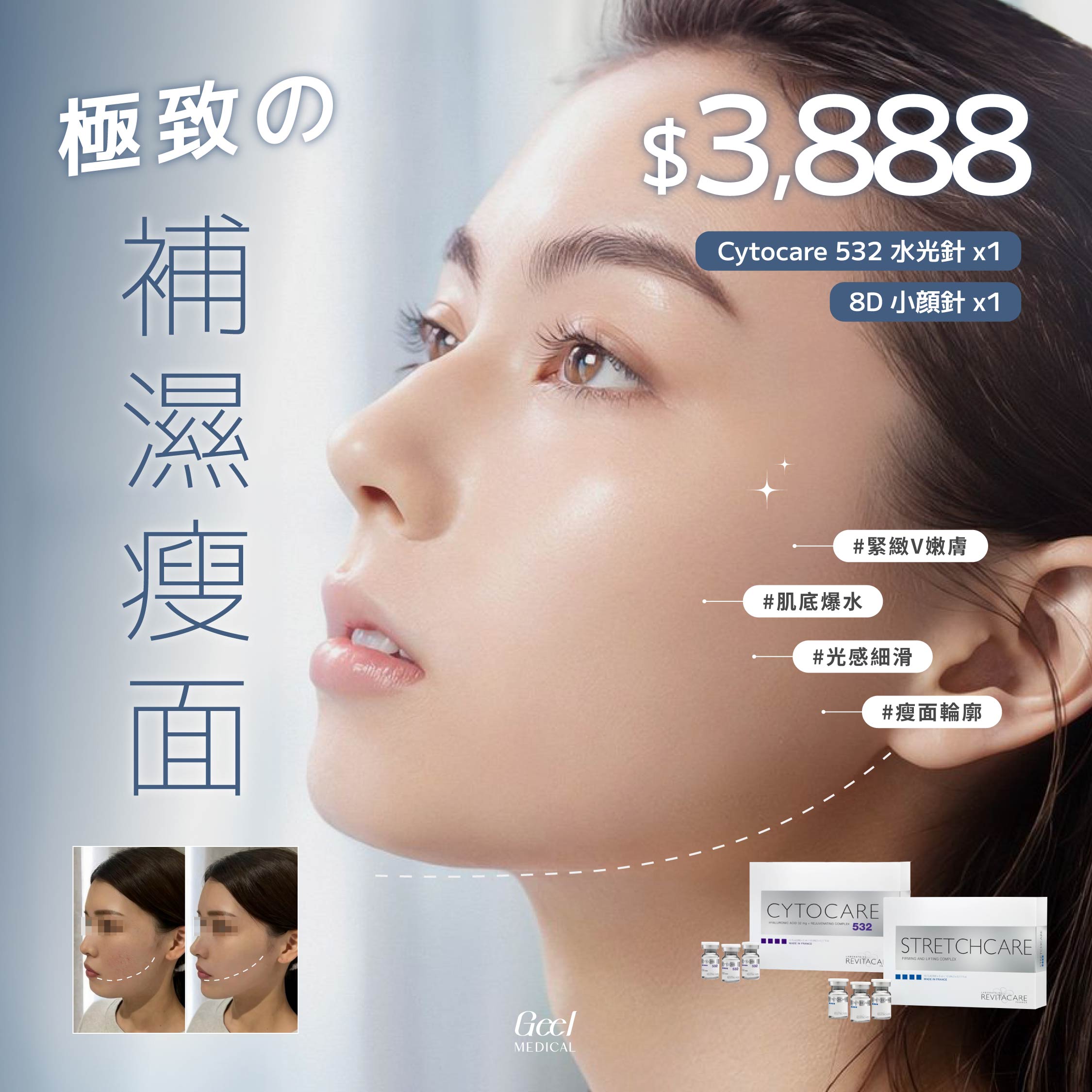 IG FEED / 240330-2