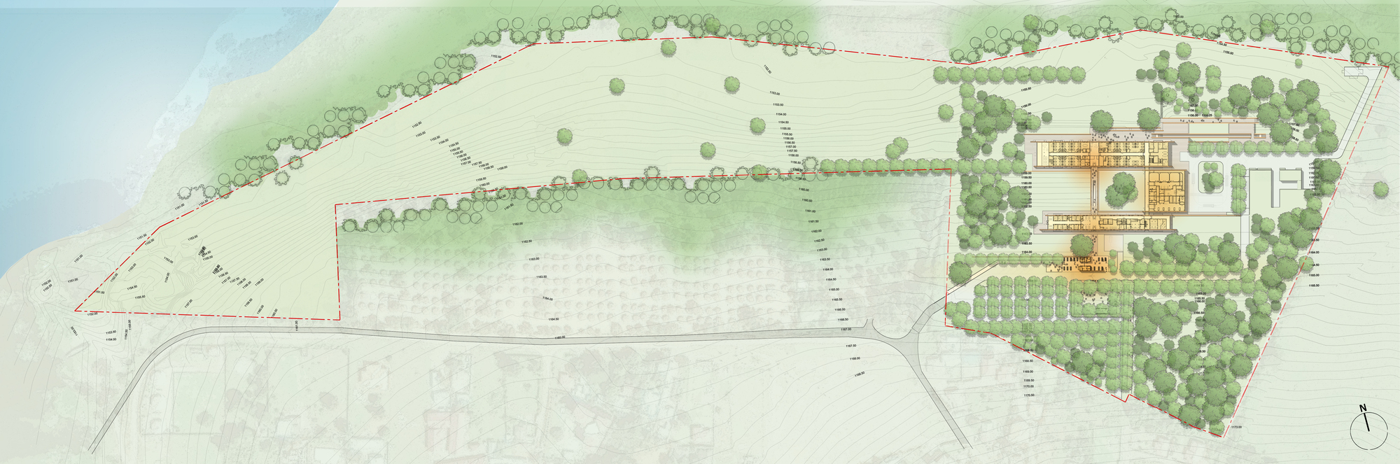 儿童外科医院丨乌干达-16