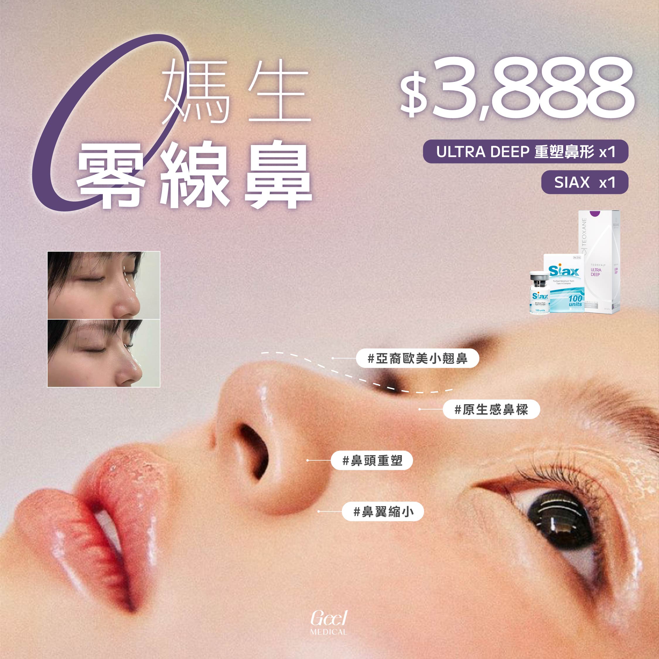 IG FEED / 240330-1