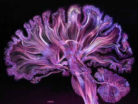 神经艺术 · 探索科学可视化的创新之路-12