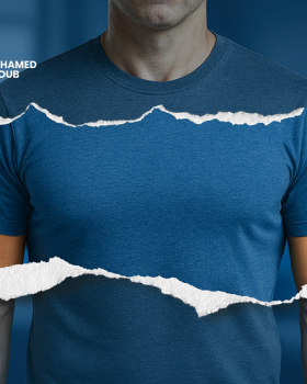 Dr.Mohamed Ayoub - Plastic Surgeon Campaign