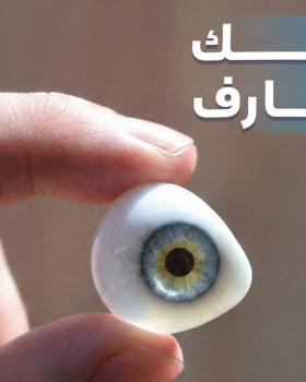 Dr.Magdy Sobhy - Ocularist campaign