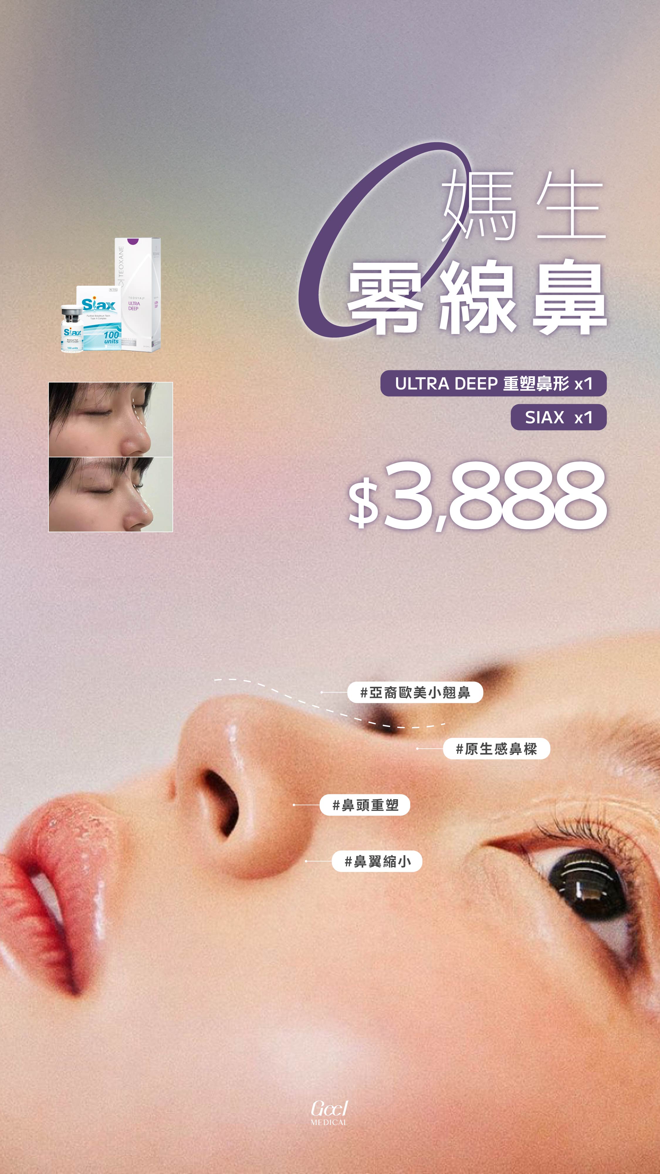 IG FEED / 240330-5