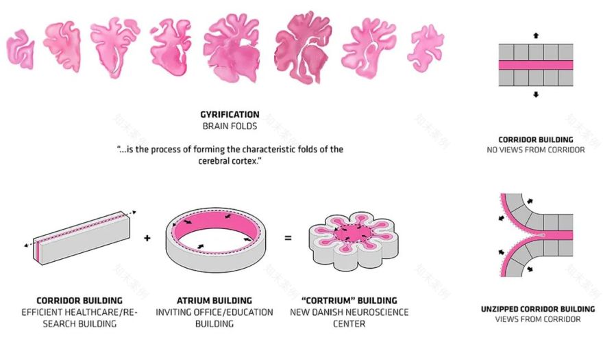 丹麦神经科学中心丨丹麦奥胡斯丨BIG-7