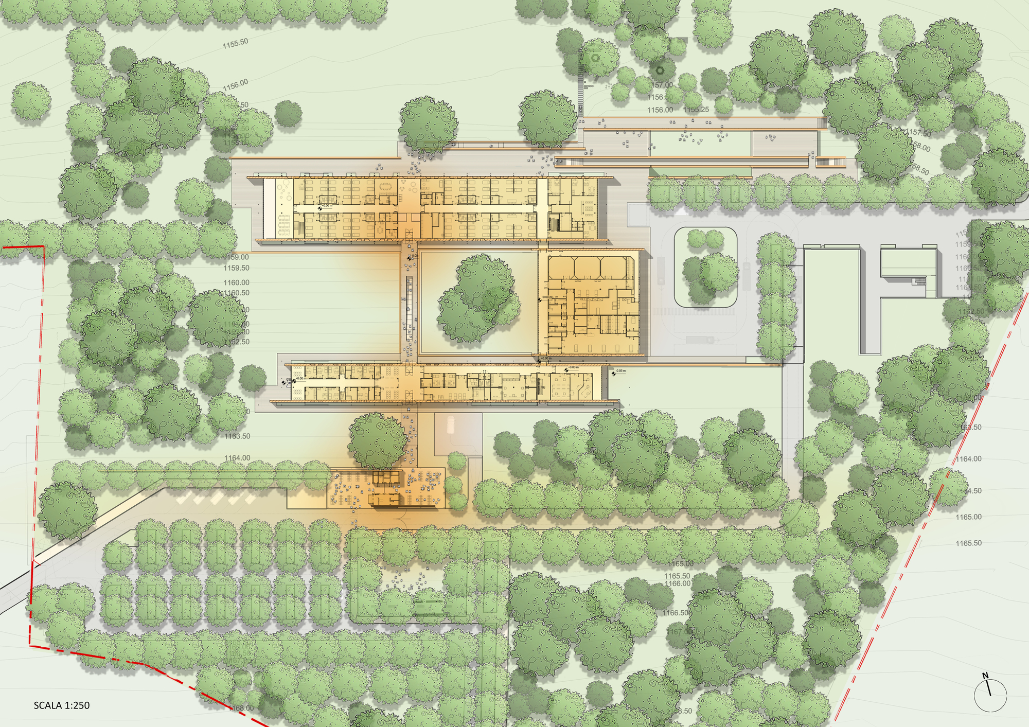 儿童外科医院丨乌干达-17
