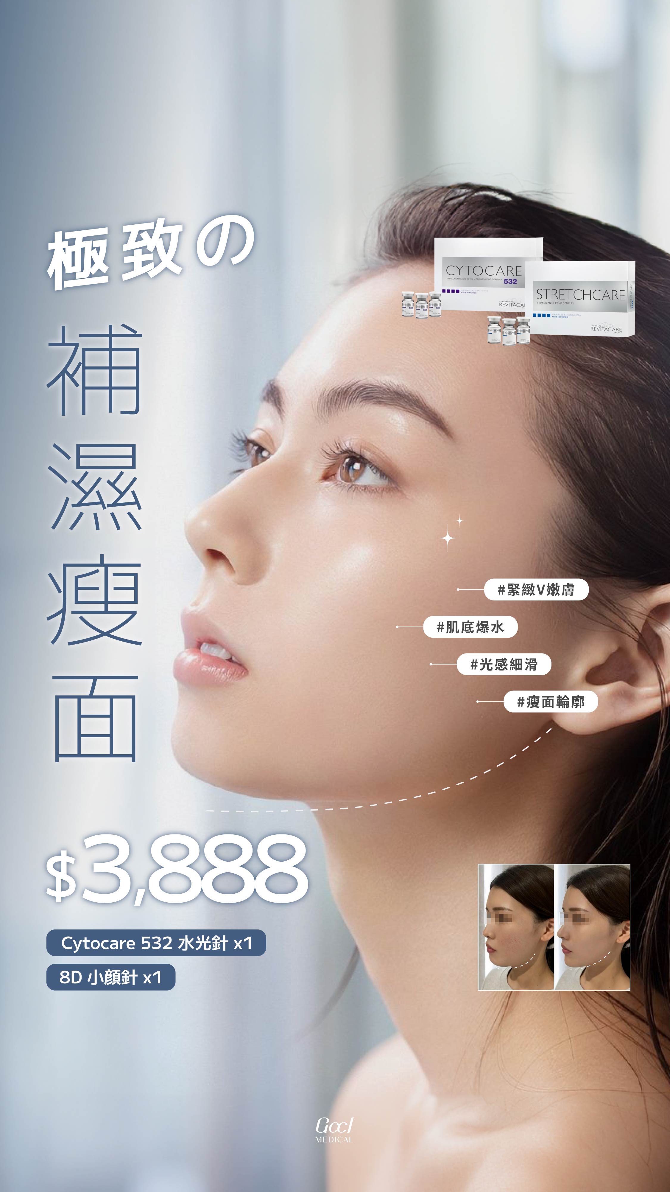 IG FEED / 240330-6